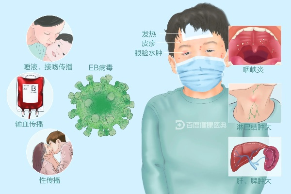 病毒感染有什么症状表现:皮肤病毒感染有什么症状表现 病毒感染有什么症状表现:皮肤病毒感染有什么症状表现