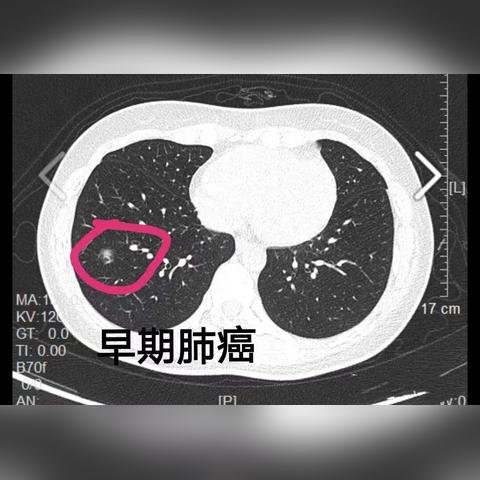 31省区市新增11例新冠肺炎:31省区市新增新冠肺炎确诊病例28例