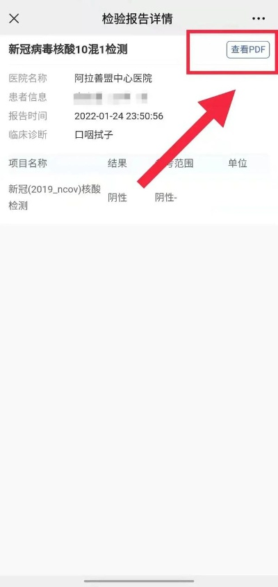 怎么查核酸结果/怎样查询核酸检验结果 怎么查核酸结果/怎样查询核酸检验结果