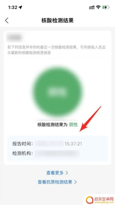 【核酸结果怎么在手机上查,核酸检测结果在手机上如何查】 【核酸结果怎么在手机上查,核酸检测结果在手机上如何查】